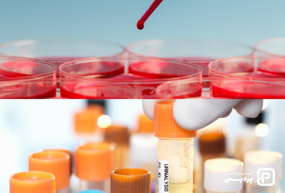 روش های تشخیص سرطان و چگونگی انجام آن ها 2 روشهای تشخیص سرطان