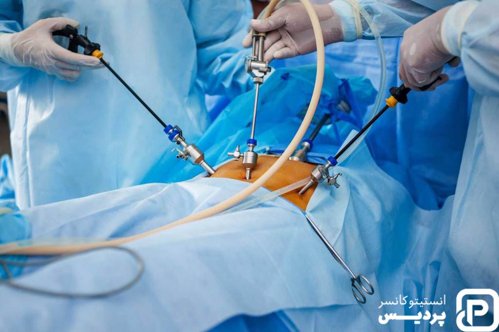 روش های درمان سرطان روده 