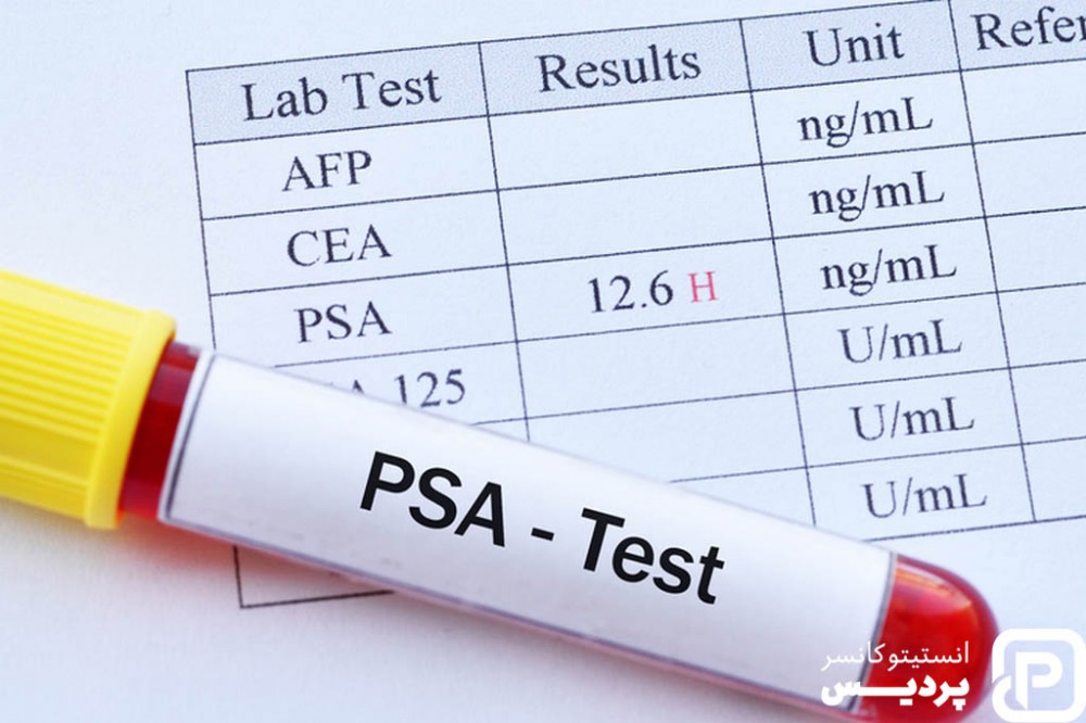 سرطان پروستات 