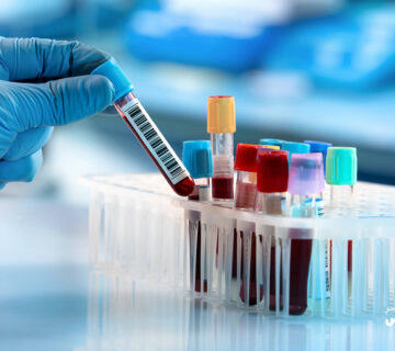 روش های تشخیص سرطان و چگونگی انجام آن ها - 26