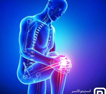 سرطان استخوان چیست؟ علائم و راه های درمان آن - 1