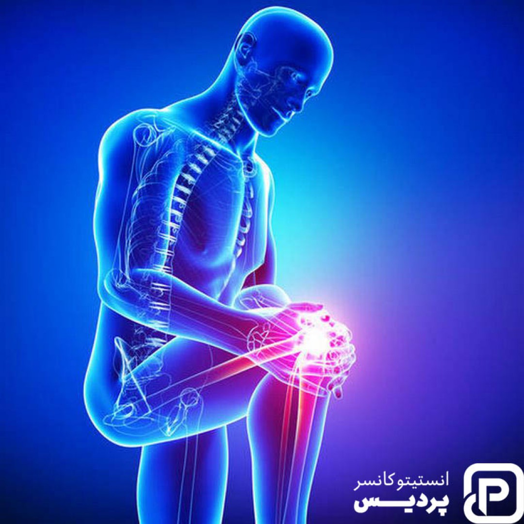 سرطان استخوان چیست؟ علائم و راه های درمان آن - 1