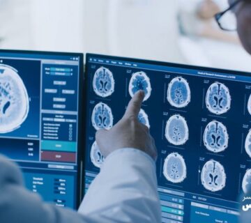 بهترین آزمایش های تصویربرداری برای تشخیص سرطان 10 Image 655e45ececee2 360x320