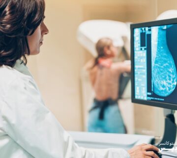 هرآنچه باید درباره ماموگرافی بدانید – مزایا، مراحل و انواع غربالگری - 5