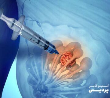چگونه بیوپسی پستان به تشخیص سرطان سینه کمک می کند؟ - 8