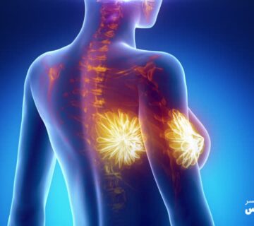 انواع نادر سرطان سینه را بشناسید - 11