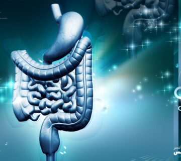 با روش های درمان سرطان روده بزرگ، چگونگی و عوارض آنها بیشتر آشنا شوید - 3