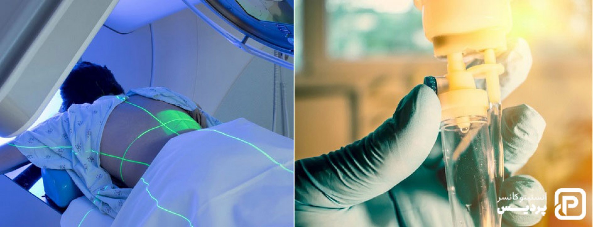 تفاوت های شیمی درمانی و پرتو درمانی را بهتر بشناسید - 1