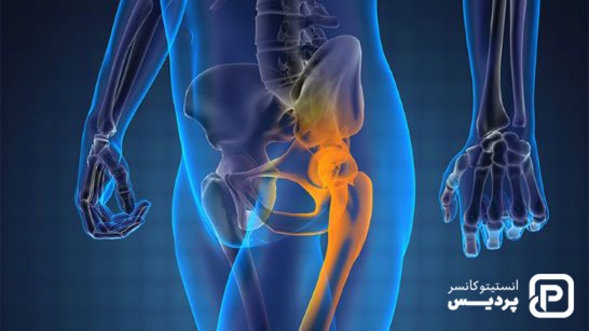 سرطان پروستات پیشرفته، علائم و نشانه ها و راههای تشخیص و درمان آن 1 سرطان پروستات پیشرفته، علائم و نشانه ها و راههای تشخیص و درمان آن - 1