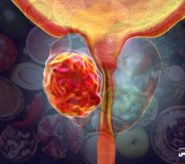 رژیم غذایی سالم و تأثیر آن بر پیشگیری ازسرطان پروستات - 8