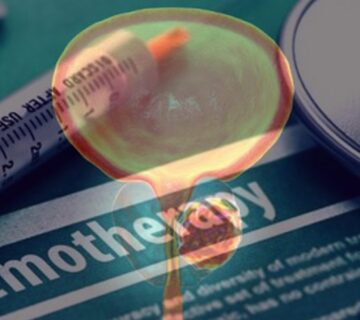 نقش شیمی درمانی در درمان سرطان پروستات - 22