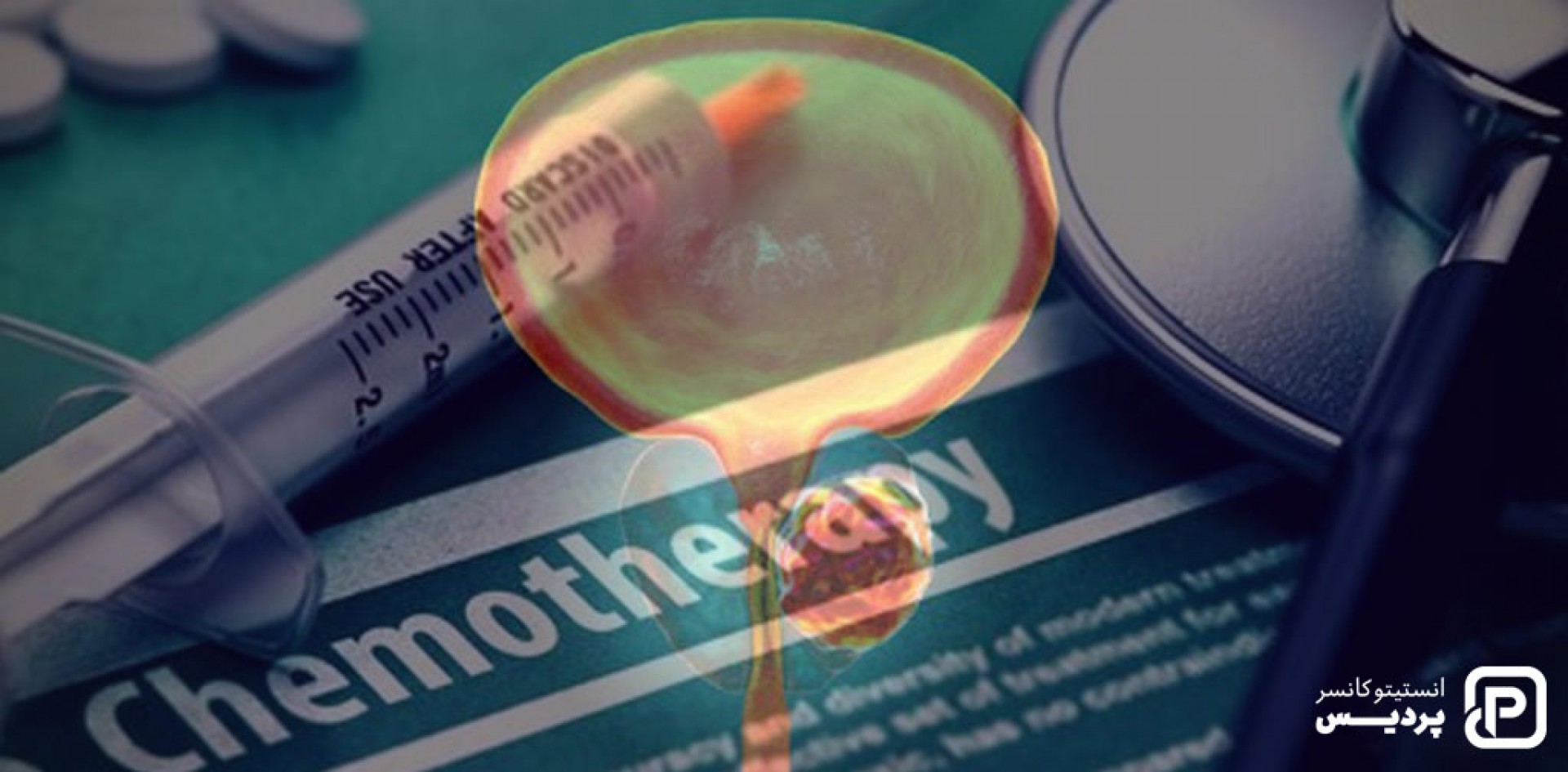 نقش شیمی درمانی در درمان سرطان پروستات - 1