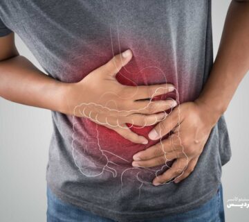 پولیپ روده | علائم، تشخیص و راه‌های پیشگیری از سرطان روده بزرگ - 3