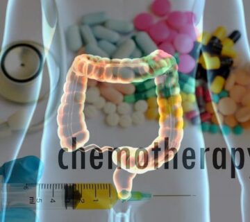 شیمی درمانی چگونه به درمان سرطان روده بزرگ کمک می کند؟ - 33