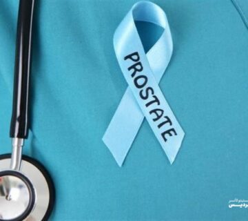 انواع نادر سرطان پروستات را بشناسید - 4