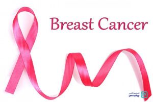 درمان سرطان سینه با روش درمان هدفمند - 11