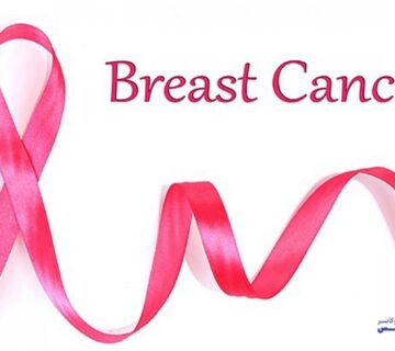 درمان سرطان سینه با روش درمان هدفمند - 14