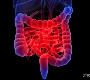 روش های تشخیص سرطان روده کوچک - 4