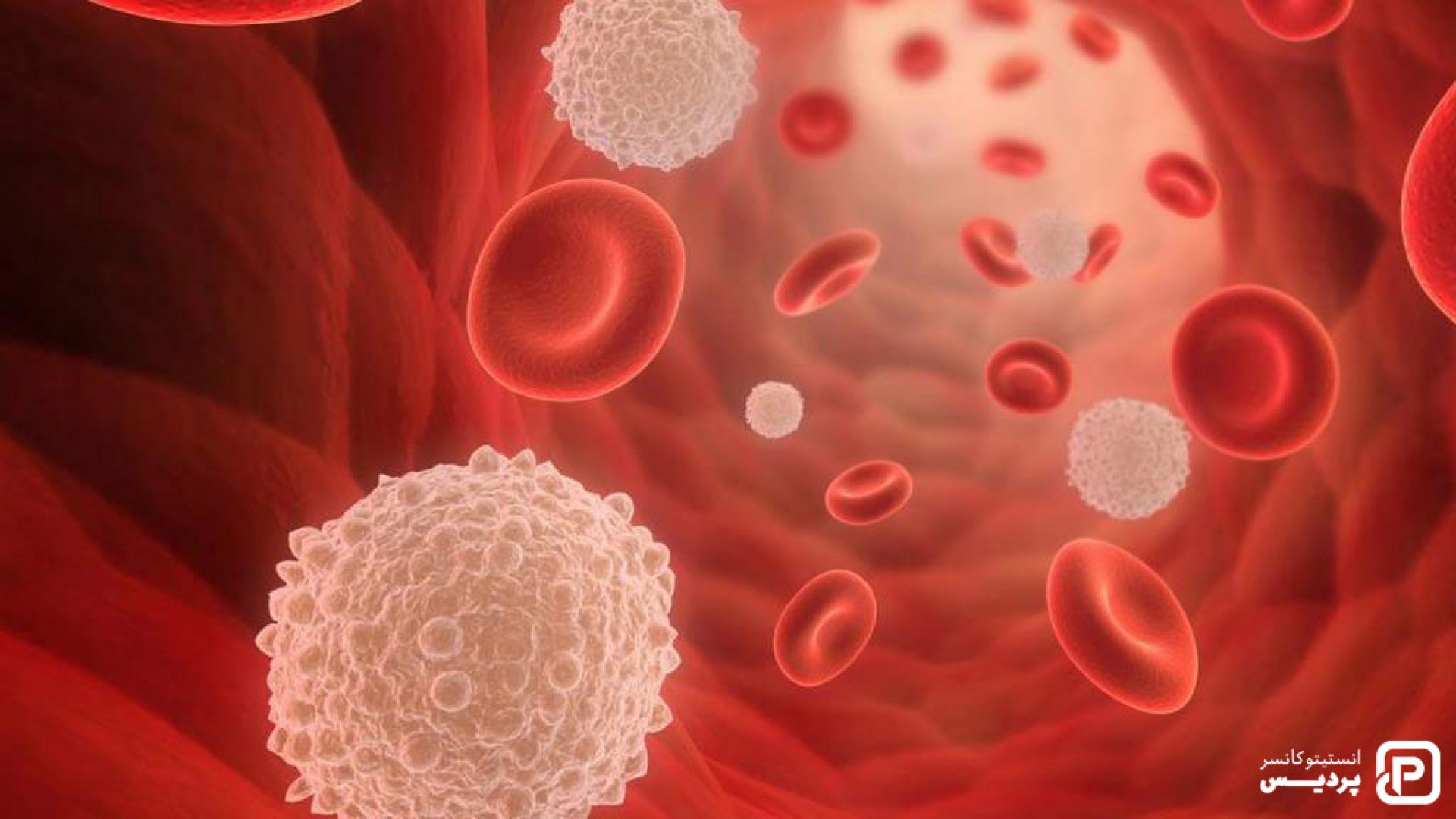 مرحله بندی سرطان خون چگونه انجام می شود و چه معیارهایی دارد - 1