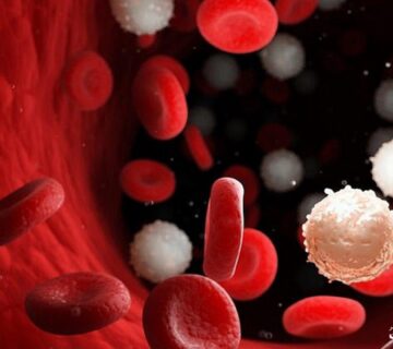 انواع سرطان خون و و راههای درمان آن را بشناسید - 18