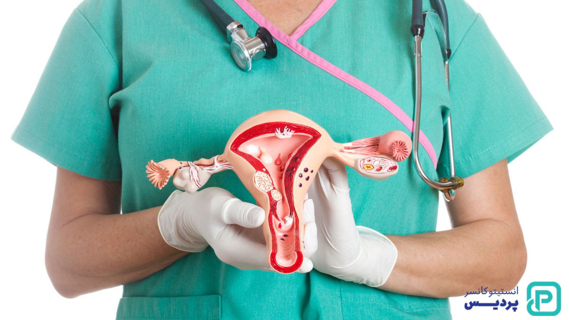 سرطان دهانه رحم چیست؟ علائم اولیه و راه‌های تشخیص - 1