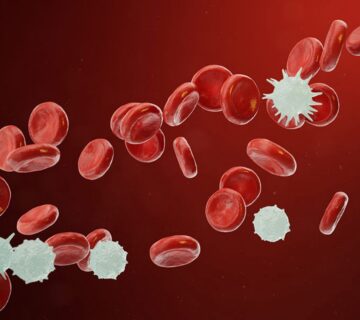 علائم سرطان خون و عوامل خطر ابتلا به آن را بشناسید - 25