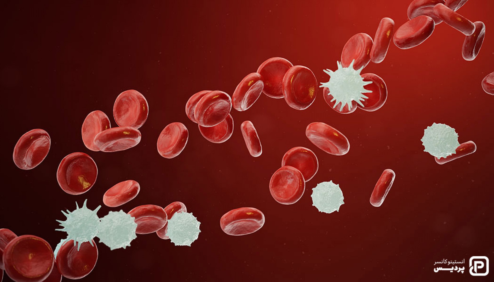 علائم سرطان خون و عوامل خطر ابتلا به آن را بشناسید 1 علائم سرطان خون و عوامل خطر ابتلا به آن را بشناسید - 1