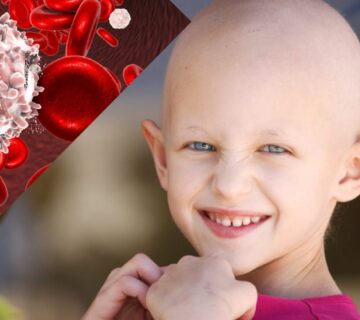 با علائم و نشانه های سرطان خون در کودکان آشنا شوید - 30