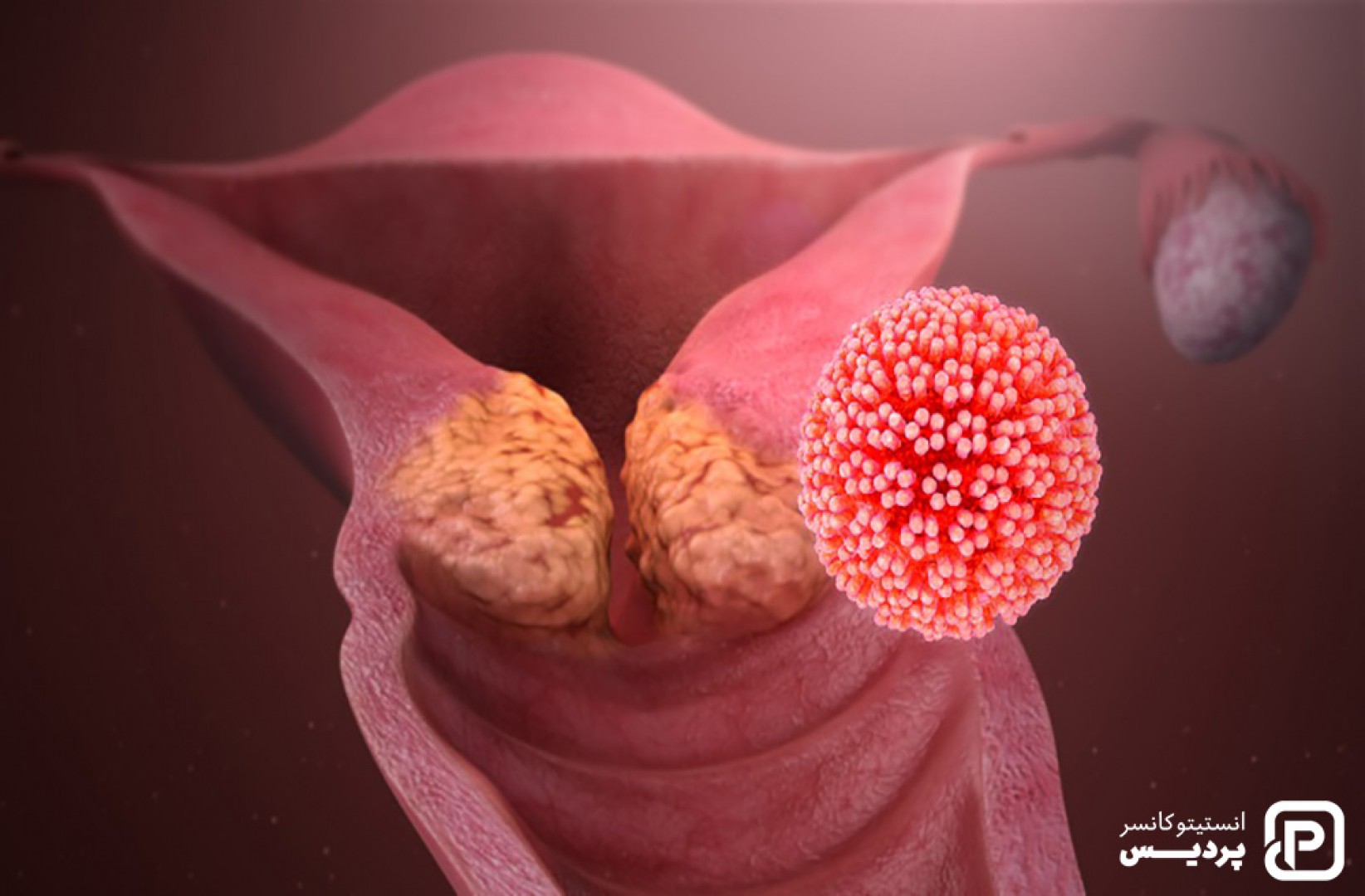 عوامل افزاینده خطر ابتلا به سرطان دهانه رحم - 1