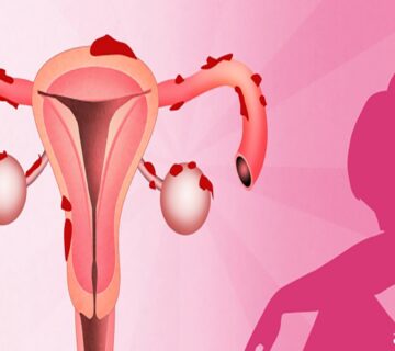 تشخیص سرطان دهانه رحم به چه صورت انجام می شود؟ - 11