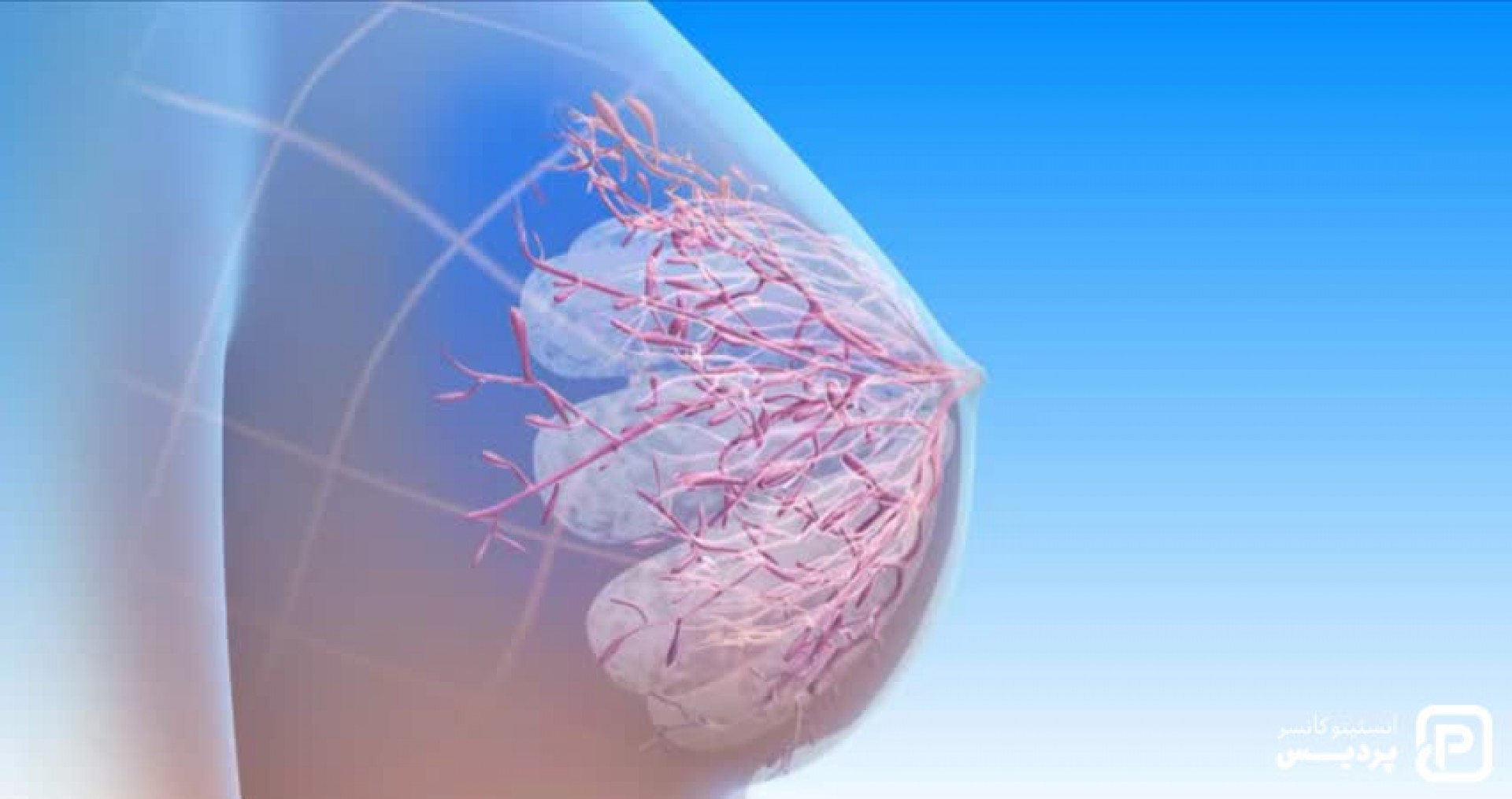 سرطان سینه و هر آنچه که درباره سرطان پستان باید بدانید 1 سرطان سینه و هر آنچه که درباره سرطان پستان باید بدانید - 1