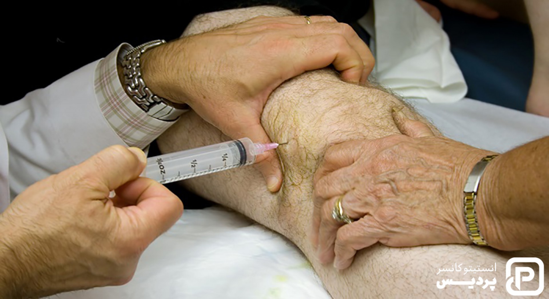 سرطان استخوان چگونه درمان می شود؟ - 1