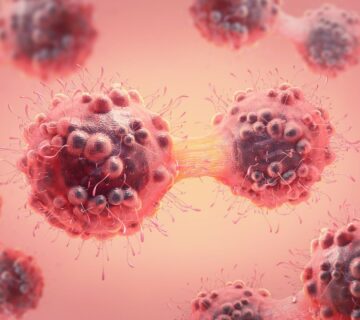 5 مورد از کشنده ترین سرطان ها - 2