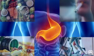 چگونه می توان از سرطان معده پیشگیری کرد - 8