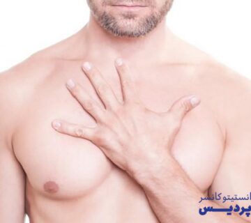 شیمی درمانی سرطان سینه مردان - 29