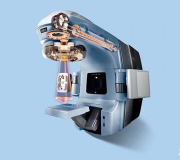 IMRT چیست و چگونه به درمان سرطان کمک می کند - 1