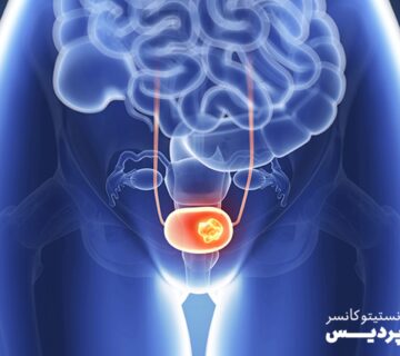 همه چیز در مورد سرطان مثانه - 18
