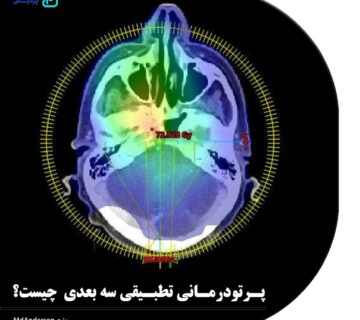 پرتو درمانی تطبیقی سه بعدی چیست؟ - 1