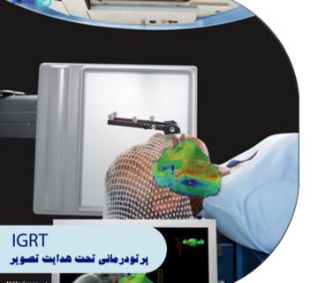 پرتو درمانی تحت هدایت تصویر IGRT چه کاربردی دارد - 2