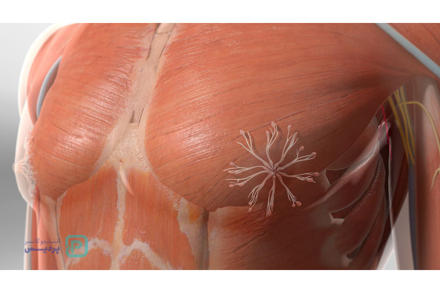 درمان هدفمند روش مؤثر برای درمان سرطان سینه مردان 