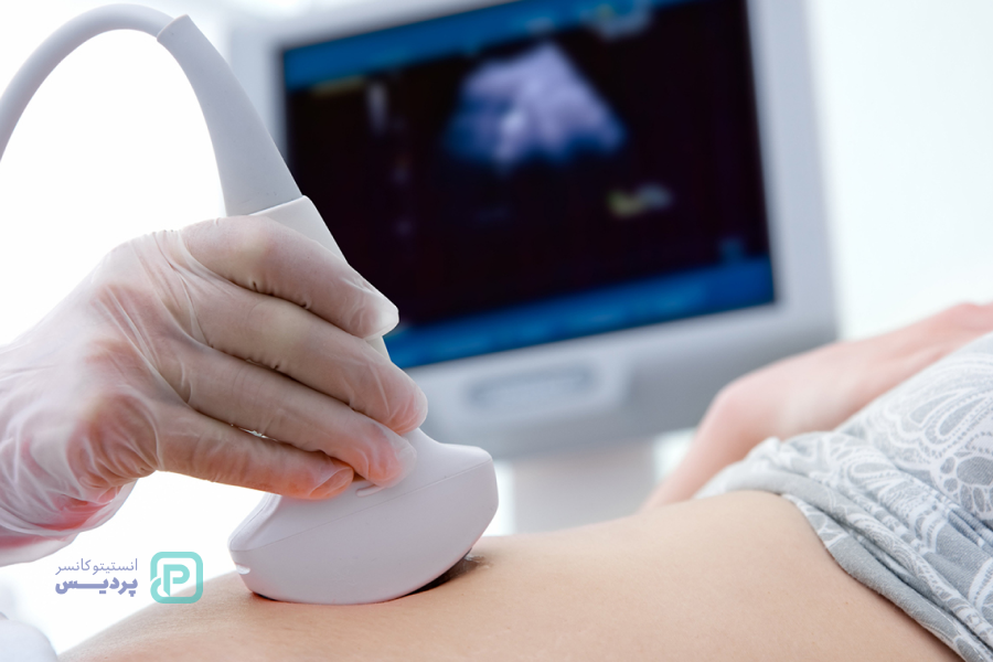 سونوگرافی چیست؟