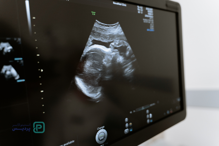 مزایای سونوگرافی