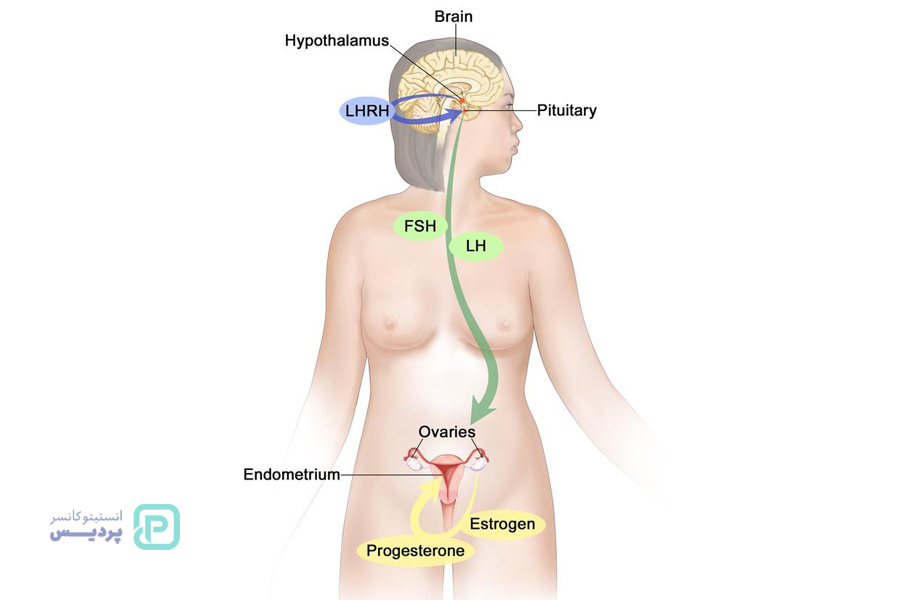 نقش هورمون درمانی در درمان سرطان سینه 4 چگونه هورمون درمانی برای درمان سرطان سینه استفاده می شود؟