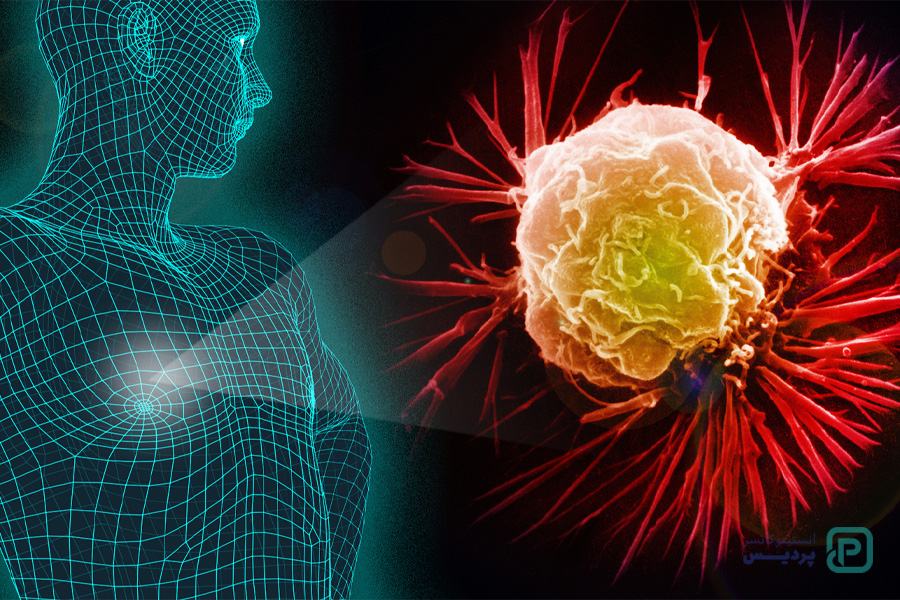 شیمی درمانی سرطان سینه مردان 3 سرطان سینه مردان و درمان آن