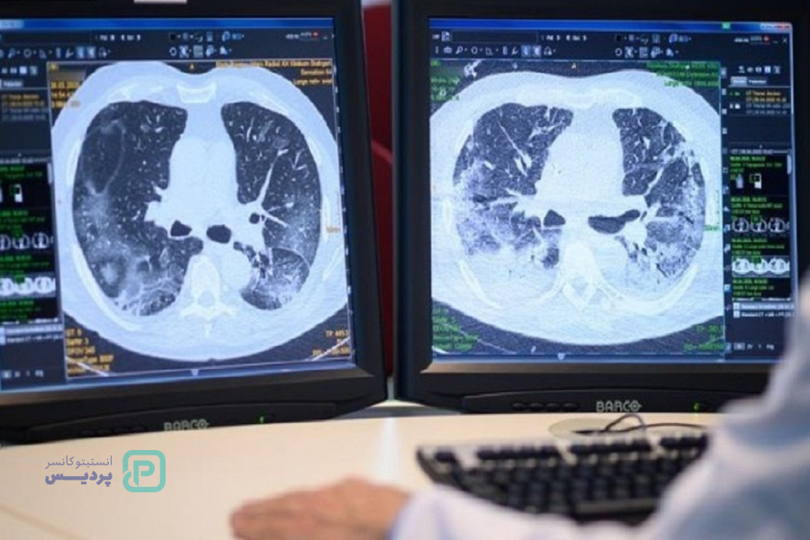بهترین سی تی اسکن کنسر در شیراز