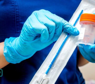 آزمایش پاپ اسمیر چیست؟ روش انجام، تفسیر نتایج و اهمیت آن در سلامت زنان - 3