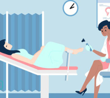 بهترین زمان تست پاپ اسمیر چه زمانی است؟ - 10