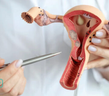 غربالگری سرطان دهانه رحم چیست؟ 0 تا 100 آزمایش غربالگری - 9