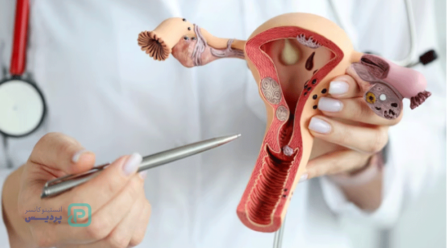 غربالگری سرطان دهانه رحم چیست؟ 0 تا 100 آزمایش غربالگری 1 Image 6682d0305c62f