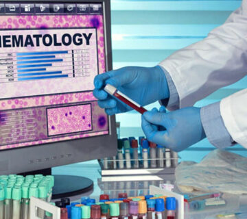 هماتولوژی چیست؟ - 3